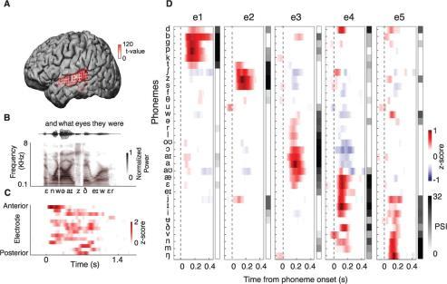 Updated research N Mesgarani et al. Science 2014;343:1006-1010 Fig. 1 Human STG cortical selectivity to speech sounds.