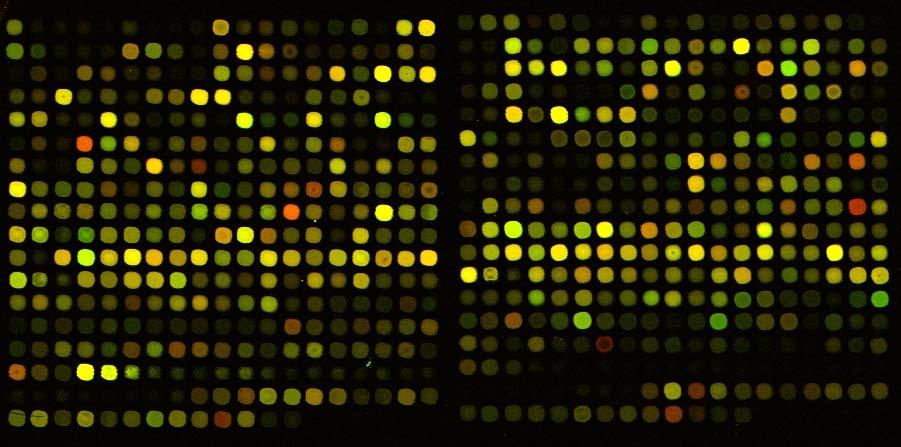 is assessed by means of the quantity of the corresponding mrna Genes expression can be measured by microarray, RT PCR.