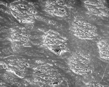 - 4 - Figure 1: SEM image showing isolated degradation of the grip material -