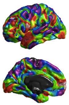 Neuroimaging Big Data Localize brain regions altered in neurological or psychiatric diseases.
