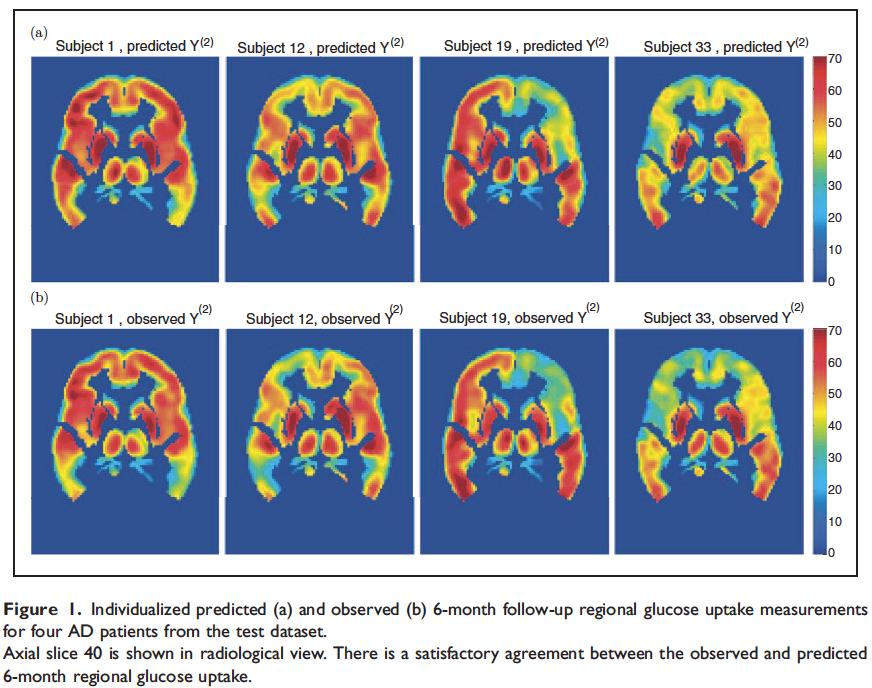 Biostatistics: Neuroimaging Predicting future brain activity in patients
