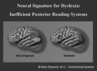 Defining Dyslexia (IDA, 2002; Cassidy-Mikulski Senate Resolution 275, 2015) What is Dyslexia? 1. a specific learning disability that is neurobiological in origin. 2. an unexpected difficulty in reading for an individual who has the intelligence to be a much better reader 3.