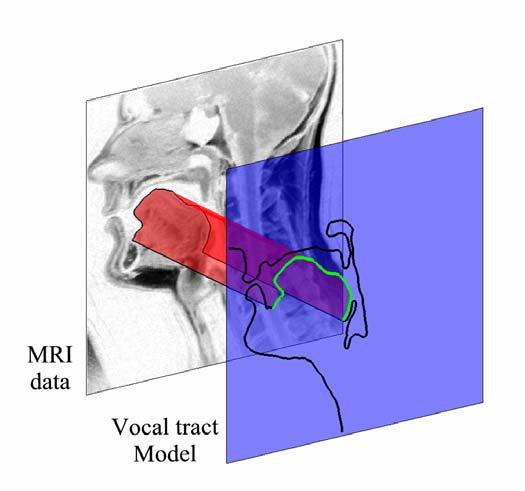 11 Figure 1.2. Example of MRI midsagittal data and the estimated vocal tract outline (thick line) for Subject 1during the production of /r/.