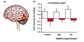 Dyslexics and the Visual Word Form Area in imaging studies normal dyslexic Equal reduction in VWFA activation in English, French, and Italian dyslexics, despite differing degrees of