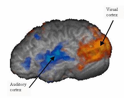 Mapping ACT-R R onto the brain Visual Buffer (Parietal) Modules