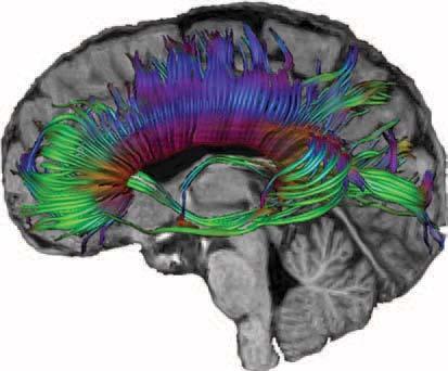 Neuroimaging Findings