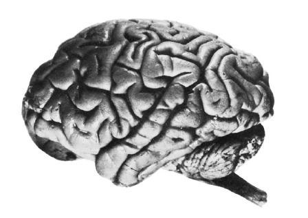 LANGUAGE AREAS IN THE LH left hemisphere Aphasia usually follows left hemisphere damage: 1 st report of the asymmetry of human brain functions (Broca, 1865)
