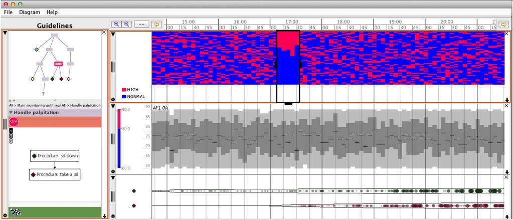 Figure 3: Gnaeus, a guideline-based knowledge-assisted electronic health records visualization for cohorts [33]. Figure 4: Scipio, a plugin of Gnaeus [33] for simulating patient cohorts.