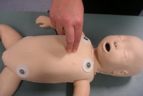 RESUS4KIDS When Cardiac arrest occurs, the immediate and skilled action of the first responder is critical (Hunziker et al.