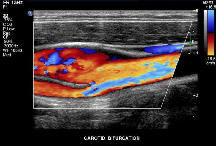 Clinical Concentrations Offered Vascular Technology Carotid studies Transcranial Doppler Extremity