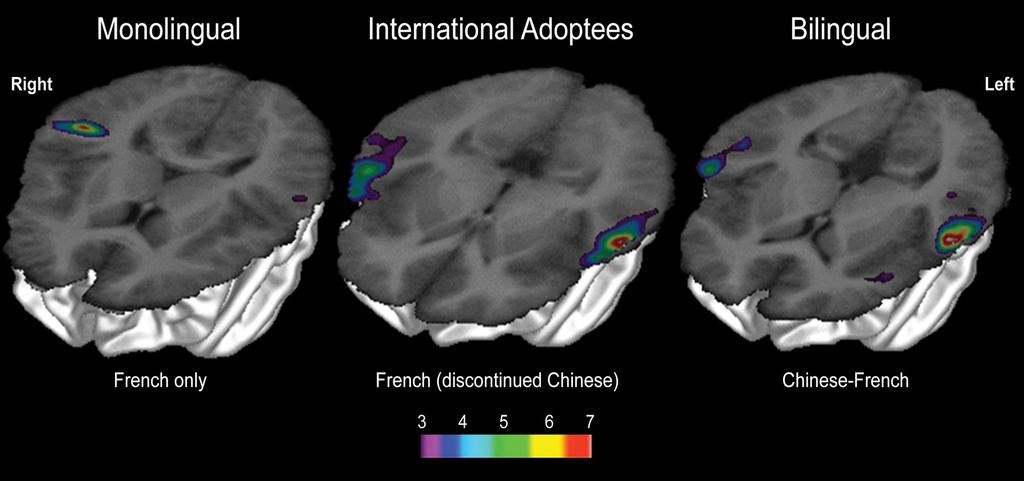 NEURO-COGNITIVE TRACES of CHINESE R