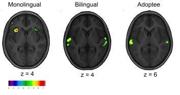NEURO-COGNITIVE PROCESSING of ADOPTED LANGUAGE LEFT RIGHT X = L anterior insula & L frontal operculum= WORKING MEMORY