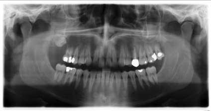 Case Study Dental