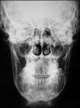 Radiology Dental