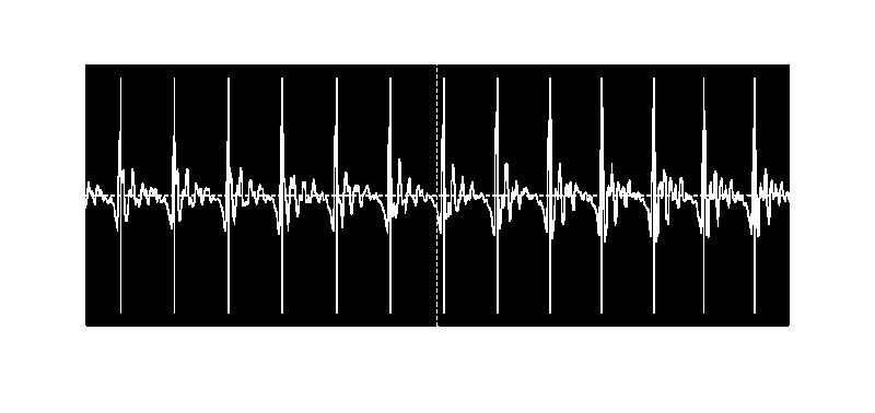 Time-domain The inventory contains the waveform plus pitch-marks for each speech unit (i.e., diphone) Units have their