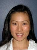 SPOTLIGHT ON THE 2014 SUS Resident Scholar Award Winners Lily S.Cheng, MD Lily S.