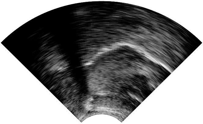 Ultrasound sample tongue 5 / 25 Csapó, Grósz,