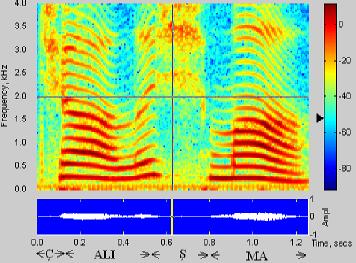 Spectrogram of (a) Dysphonic Speech (b) Normal Speech Several studies