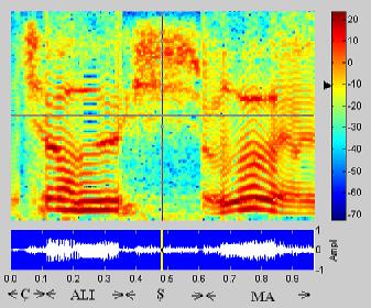 Figure 6a shows the spectrogram of the synthetic speech for the dysphonic word çalibma (Figure 2a) produced by the modification of every phoneme, whereas Figure 6b shows the spectrogram for the same