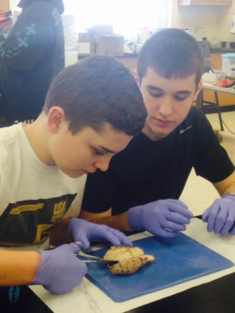 Students were introduced to basic anatomy in the classroom and observed the external features, as well as the internal physiology of the sheep brain.