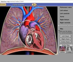 org/cases/lobar-pneumonia-ct-findings