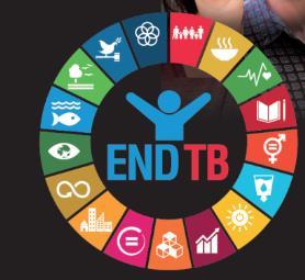 ENDING TB IN THE SUSTAINABLE DEVELOPMENT ERA: A MULTISECTORAL RESPONSE Conference Vision The WHO Global Ministerial Conference Ending TB in the Sustainable Development Era: A Multisectoral Response