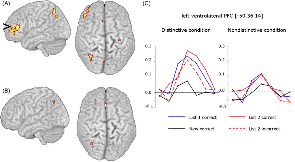 A. Raposo et al. / Neuropsychologia 47 (2009) 2261 2271 2267 Fig. 4. (A) Regions demonstrating significant increases in response to context memory retrieval of List 1 words compared to New words for the Distinctive condition.
